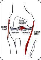 Knieblessure Knieblessure