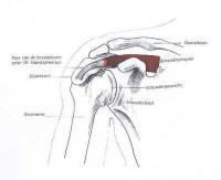 Schouderpees blessure Schouderpees blessure